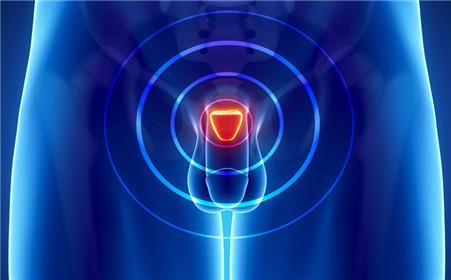 什么是前列腺液?前列腺液检查重要性